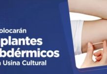 Se colocarán implantes subdérmicos en la Usina Cultural